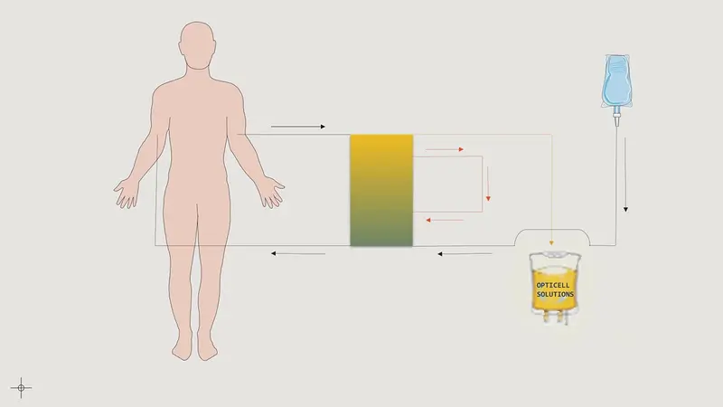 Leukapheresis